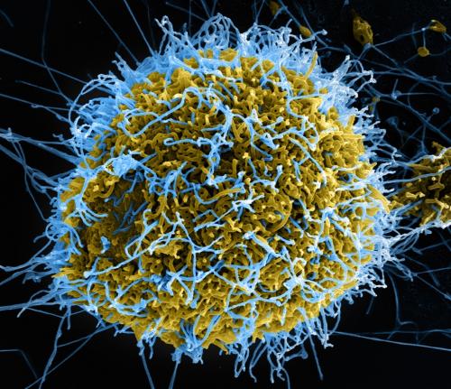 Infección dunha célula por virus Ébola