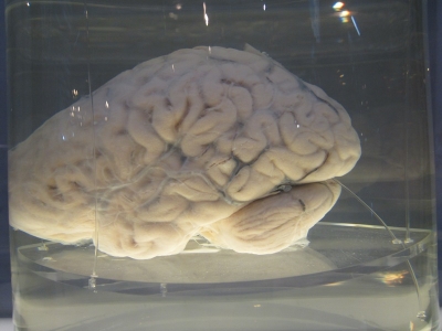     5-DOMUS: Cerebro humano
