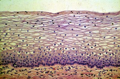 l. Epitelio plano estratificado
Vaxina
